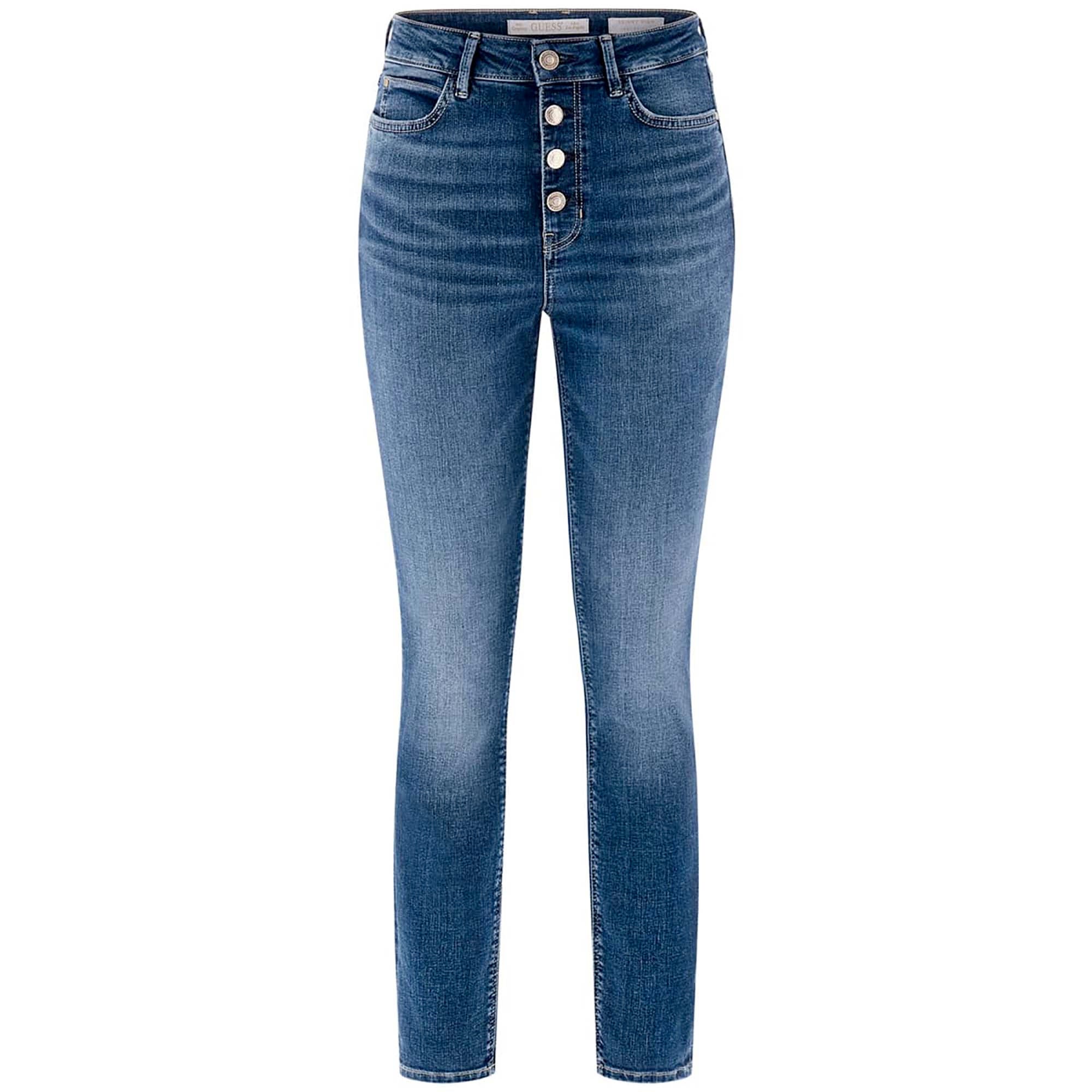 1981_EXPOSED_BUTTON_W5BA28D0793_WNL1_Image_1